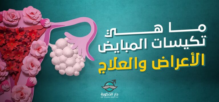 ما هي تكيس المبايض للبنات – الأعراض والعلاج