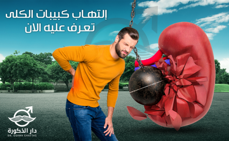 التهاب كبيبات الكلى