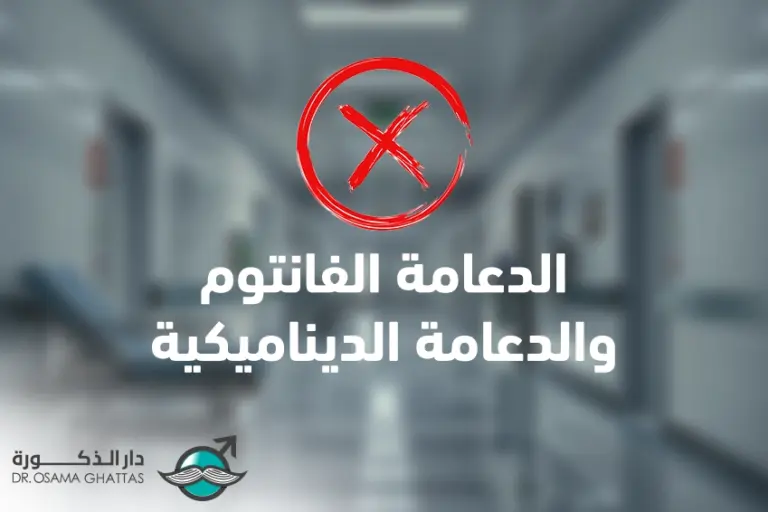 الدعامة الديناميكية أو الدعامة الفانتوم