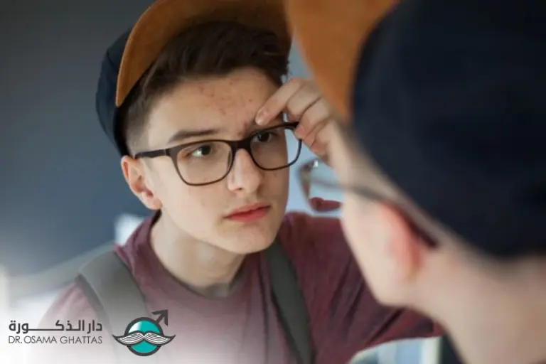 سن البلوغ عند الذكور