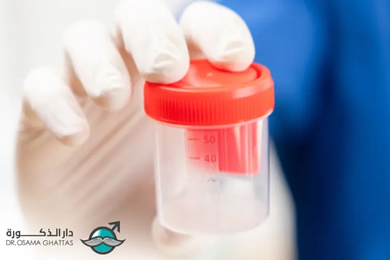 تحليل السائل المنوي للرجل